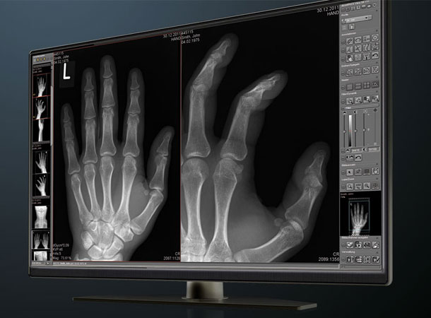 روناک طب-پکس